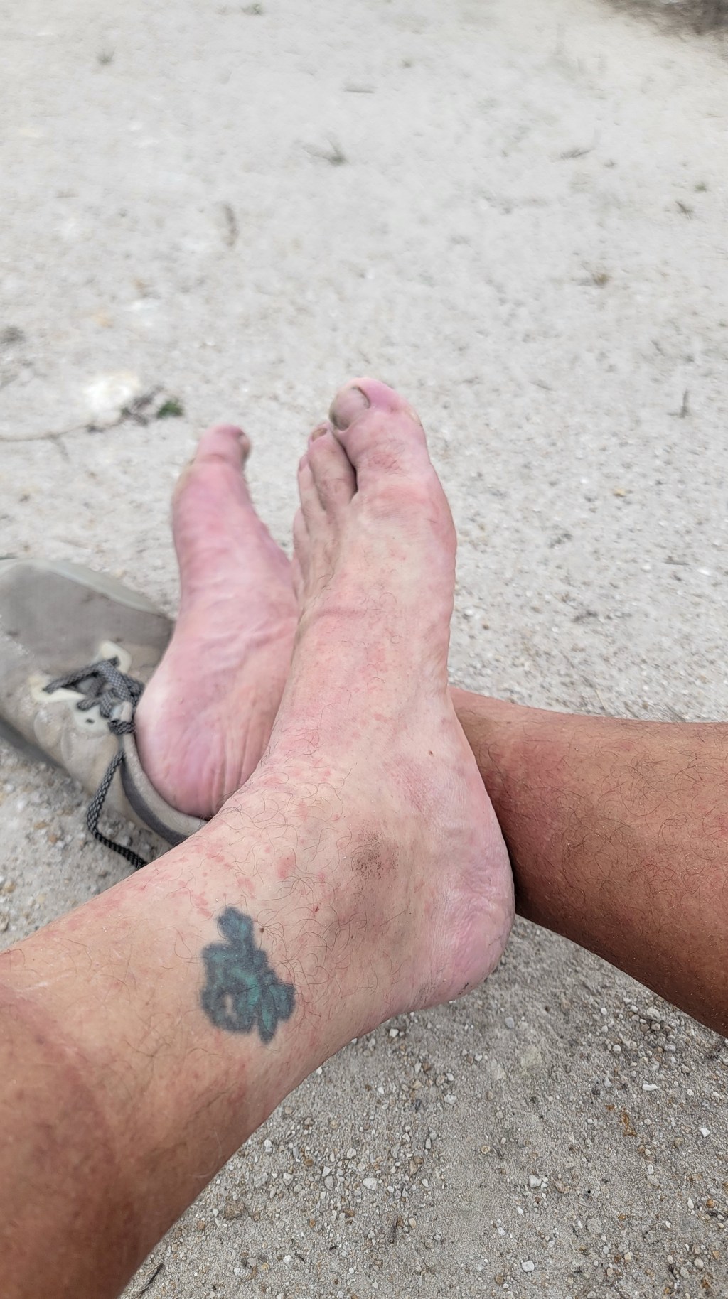 D10 – That mosquitoe&nbsp;life